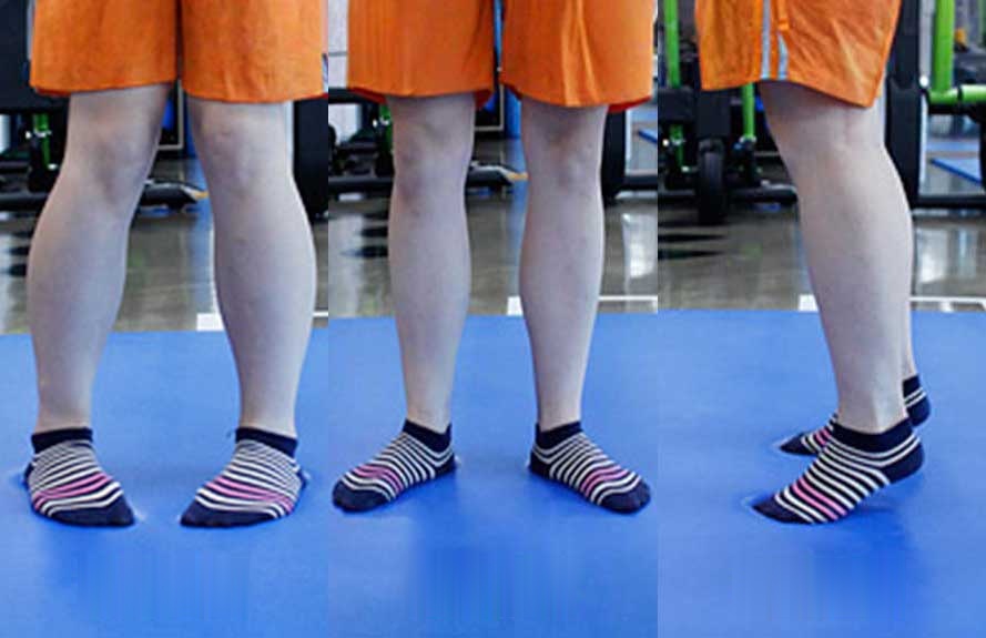 Three walking patterns: in-toeing, out-toeing and toe walking