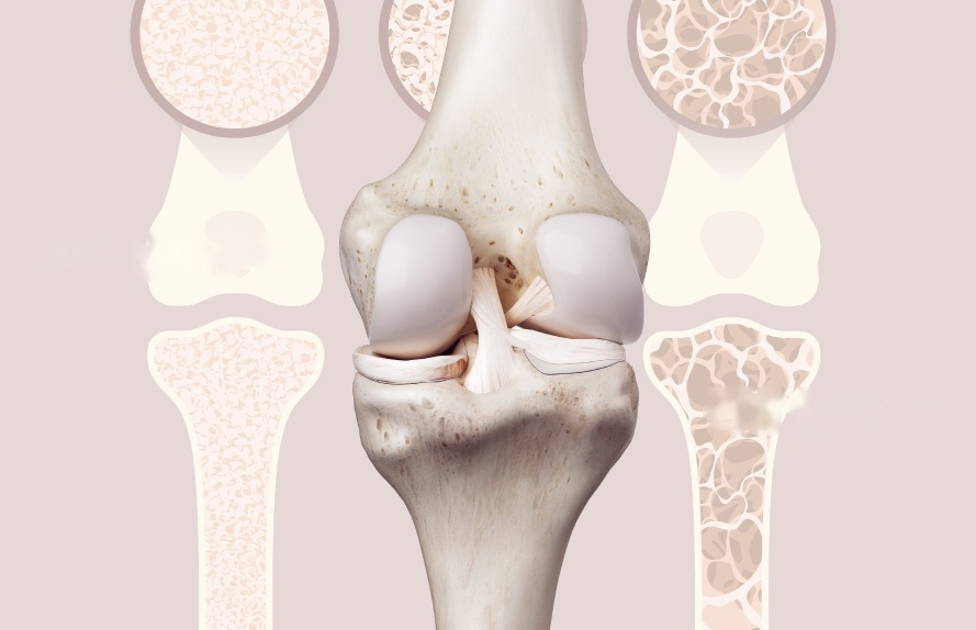 Illustration of the knee showing the posterior and anterior cruciate ligaments