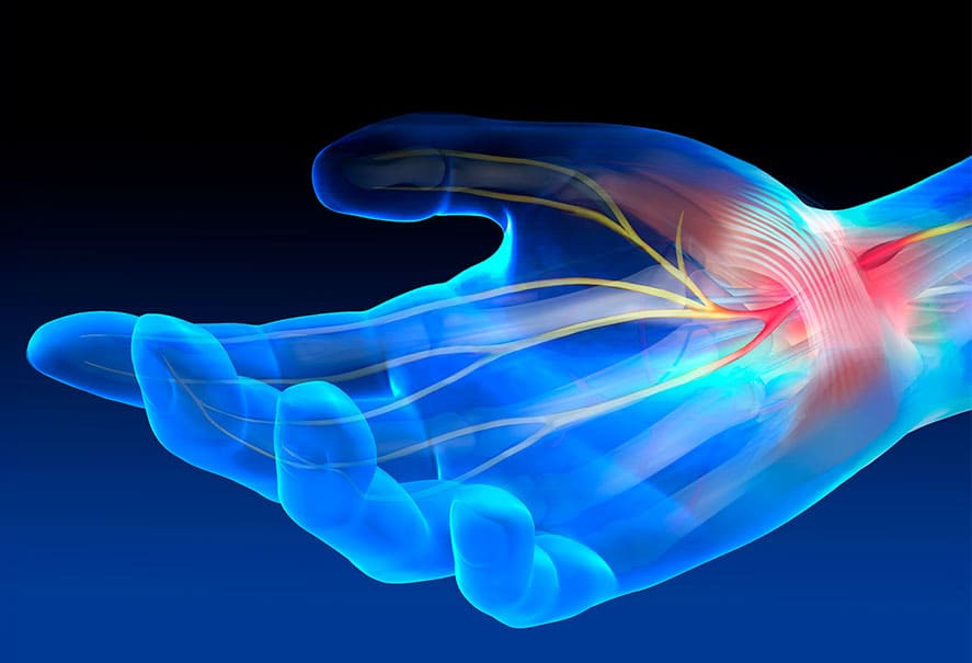 Illustration of the median nerve in the wrist