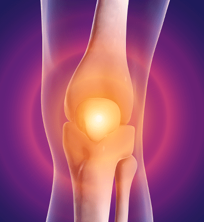 ACL and PCL tear