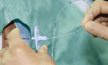 Catheter used for neuroplasty