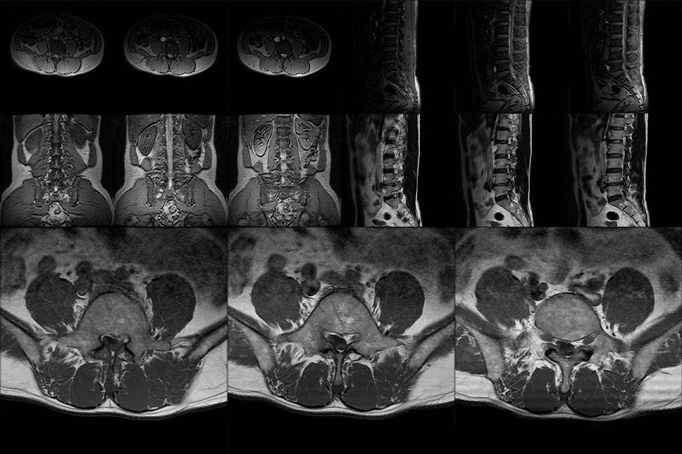 X-ray